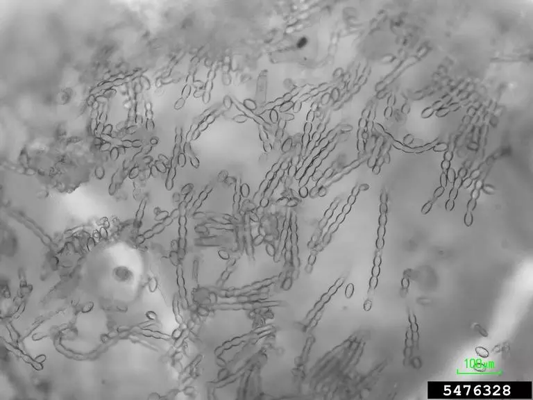 Chains of asexual Podosphaera xanthii were sampled from a pumpkin leaf infected with powdery mildew