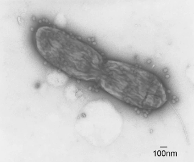 Transmission electron microscopy of Xanthomonas euvesicatoria. 