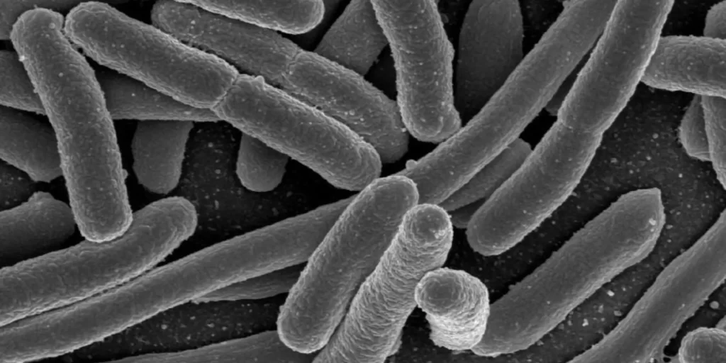 E. coli under a scanning electron microscope