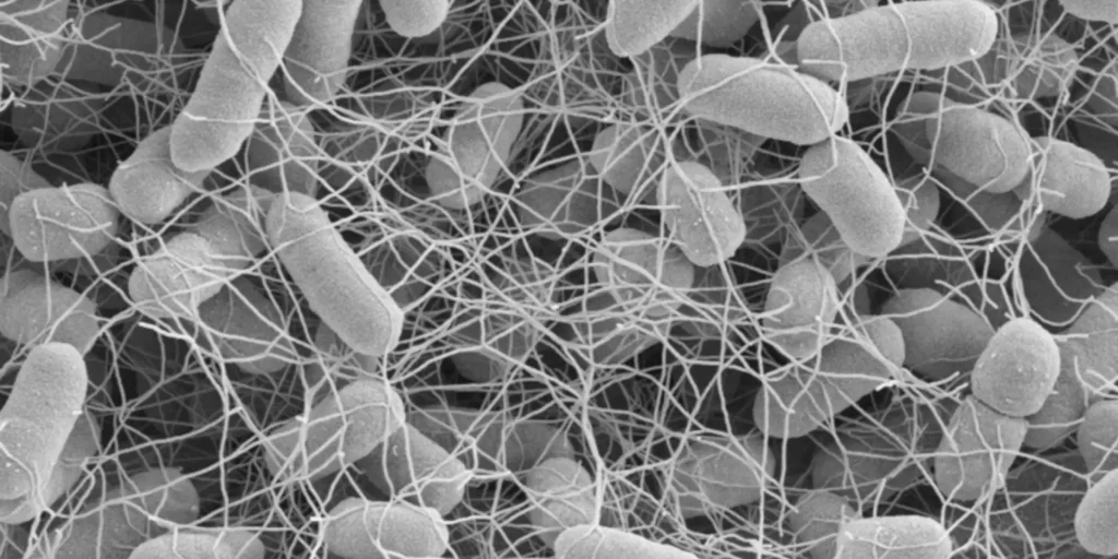 Salmonella enterica serotype typhimurium scanning electron microscopy